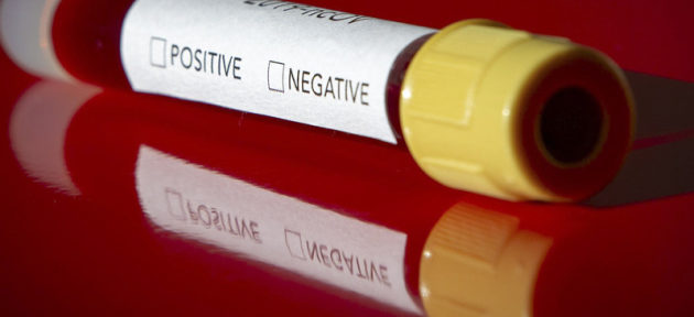 Єврокомісія підтвердила, що у вівторок 25 лютого в Італії, де протягом минулих вихідних зареєстровані вже більше двох сотень випадків захворювання на коронавірус COVID-19, розпочне роботу спільна група медиків у складі представників Єврокомісії, медустанов Італії та ВООЗ.